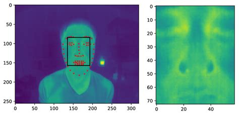 Examples Of Thermal Image With Facial Landmarks And Cut Out Thermal
