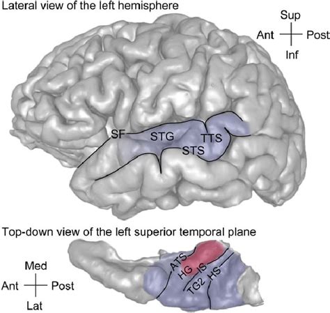 Approximate Location Of The Auditory Cortex On The Lateral Surface And