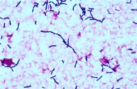 Bacillus Cereus A Volatile Human Pathogen