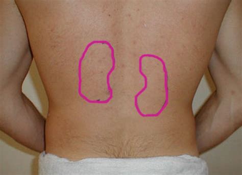 Broken ribs are most commonly caused by direct impacts — such as those from motor vehicle accidents, falls, child abuse or contact sports. Kidney Pain - Location, Causes, Treatment, Diagnosis - (2018 - Updated)