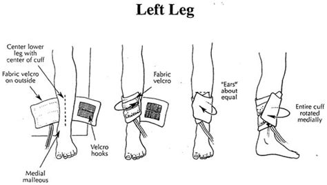 Blood Pressure Cuff Placement Left Ankle
