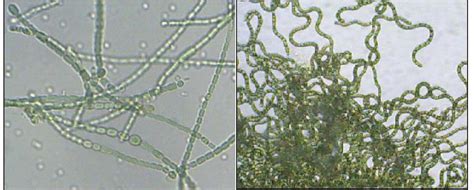 Nostoc Algae Under Microscope Micropedia