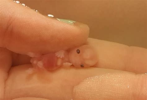 Incredible Photos Of Babies Miscarried At 7 And 8 Weeks Prove The