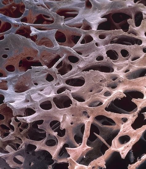 Spongy Bone Sem Stock Image P1050151 Science Photo Library
