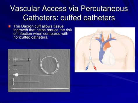 Ppt Hemodialysis Access Powerpoint Presentation Free Download Id