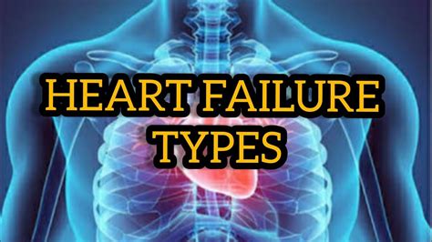 Types Of Heart Failure Pathology Lecture For Medical Students Youtube