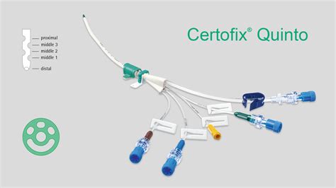 central venous catheter certofix®