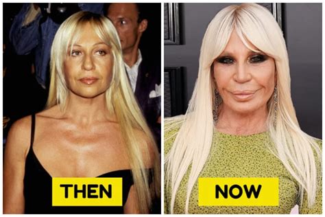 Celebrities Who Have Aged So Badly That We Couldn T Recognize Them Anymore