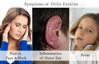 Otitis Externa Swimmer S Ear Infection Causes Symptoms Diagnosis