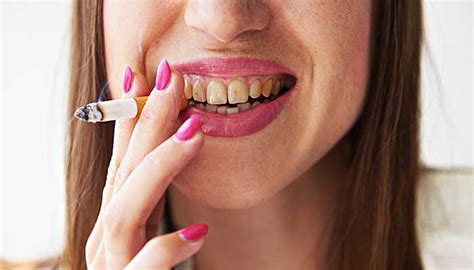 what effects can smoking have on your oral health dot environment