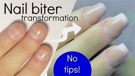 How To Fix Short Bitten Nails With Acrylic Youtube