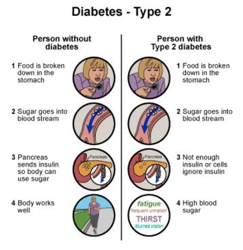 Diabetes Type 2 Hackensack Meridian Pascack Valley Medical Center