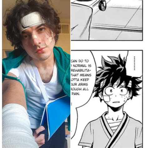 Injured Midoriya Izuku Deku Self Rcosplay