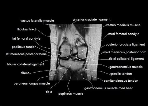 Knee Muscle Anatomy Mri