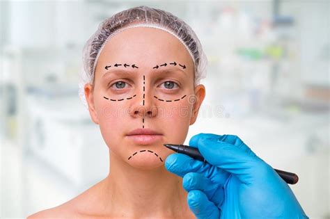 Plastic Surgery Doctor Draw Lines With Marker On Patient Face Stock