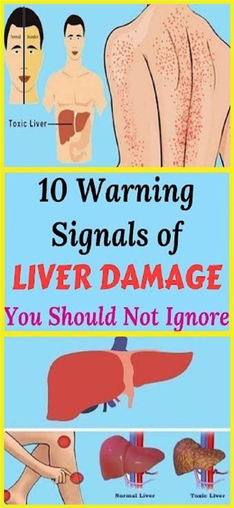 10 Warning Signals Of Liver Damage You Should Not Ignore Health And
