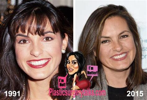 Mariska Hargitay Plastic Surgery Before And After