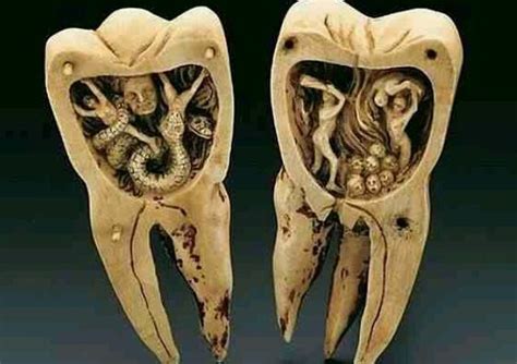 Tooth Worms Yesteryears Explanation For Cavities Boing Boing