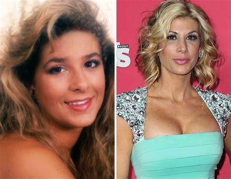real housewives cosmetic surgery confessions