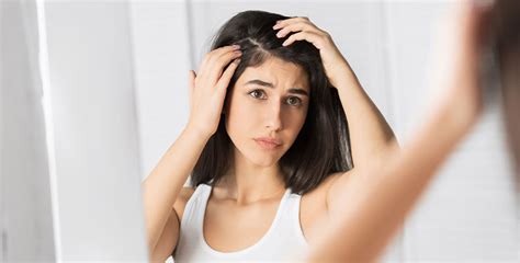 6 Causes Of Dandruff And How To Treat Them Columbia Skin Clinic