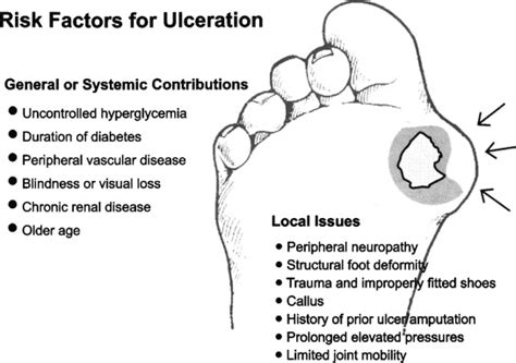 Shop Offers Diabetic Foot Disorders A Clinical Practice Guideline