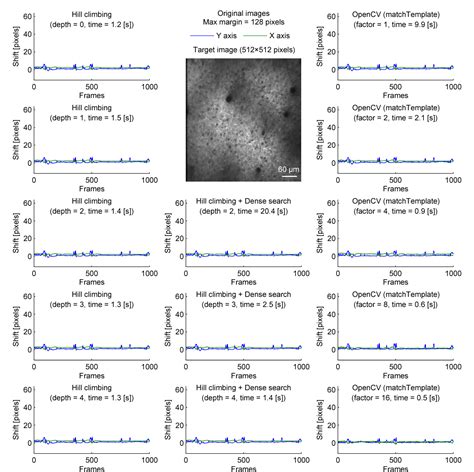 Figure 1 From Real Time Processing Of Two Photon Calcium Imaging Data