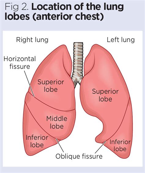 Lung Lobes Chest X Ray