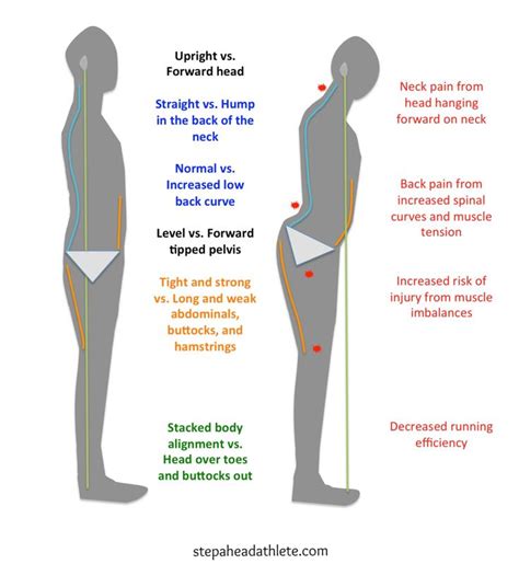 Pin By Mary Lorraine Cox On Health Spinal Alignment Back Pain