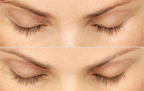 Bimatoprost, the active ingredient in latisse, is what makes eyelashes latisse is a treatment you apply to yourself each evening to get your desired eyelash thickness. 6 Things You Need to Know Before Trying Latisse ...