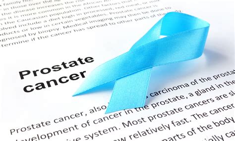 A Mix Of Treatments May Extend Life For Men With Aggressive Prostate Cancer Harvard Health