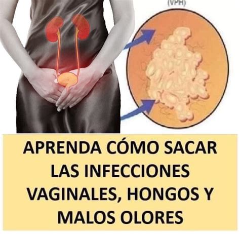Como Se Cura Una Infeccion Vajinal Cómo Prevenir La Vaginosis