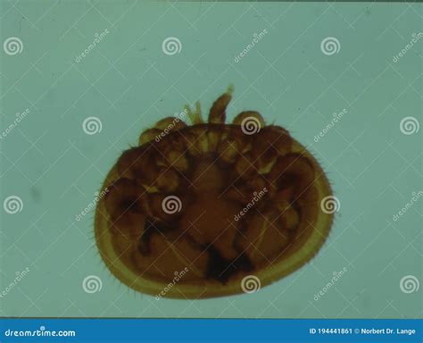 Mite Under The Human Skin Royalty Free Stock Photo