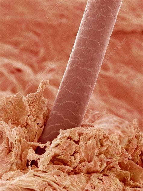 Human Hair Sem Stock Image P7200274 Science Photo Library