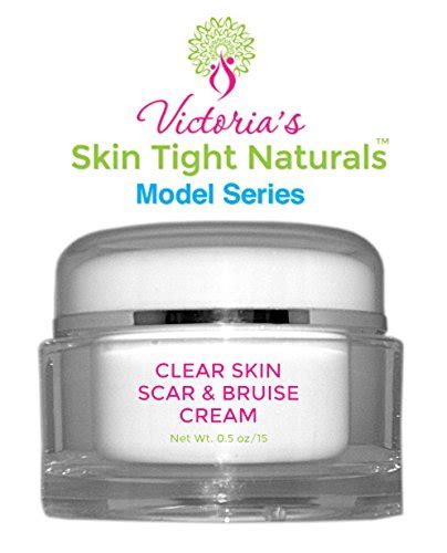 But what exactly is a bruise? Victoria's Best Clear Skin Scar and Bruise Cream Model ...