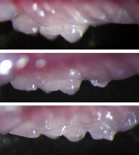 Researchers Grow New Teeth In Mice Science Aaas