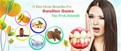 17 Science Based Home Remedies For Swollen Gums That Work Naturally