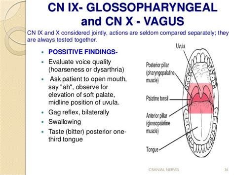 Cn Ix Glossopharyngeal Ideas Cranial Nerves Glossopharyngeal My XXX