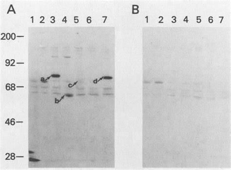 Immunoblot Detection Of Gr Fesv And Mutant Gene Products Lysates From
