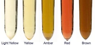 Urine Color Chart Urine Varies In Appearance Depending Principally