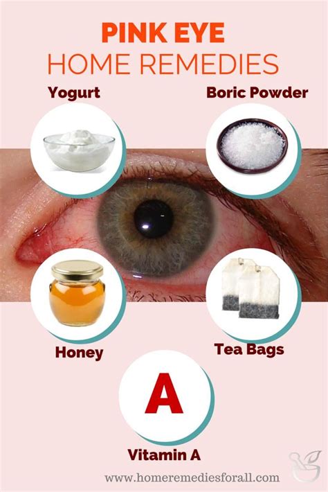 5 Home Remedies For Pink Eyes Pink Eye Home Remedies Pinkeye