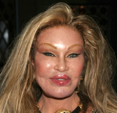Jocelyn Wildenstein Plastic Surgery Before And After Celebie