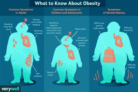 l obésité signes symptômes et complications