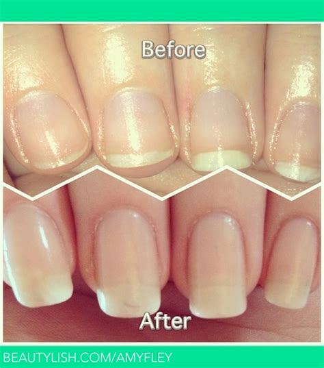 Before And After Nail Growth Amymay Ws Amyfley Photo Beautylish