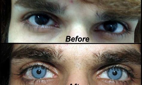 Forget Coloured Lenses Now Get Blue Or Green Eyes View Pics