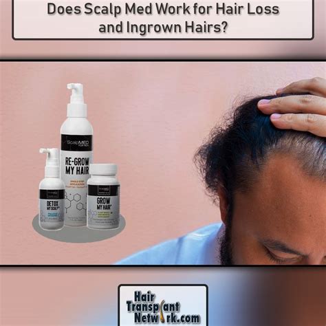 Does Scalp Med Work For Hair Loss And Ingrown Hairs Scalp Med Hair