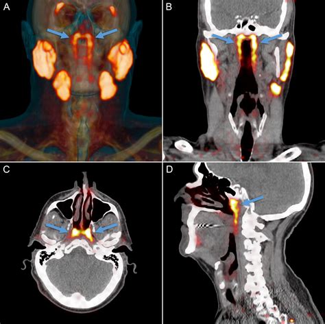 Anatomy Of A Discovery Exploring The Impact Of New Salivary Gland