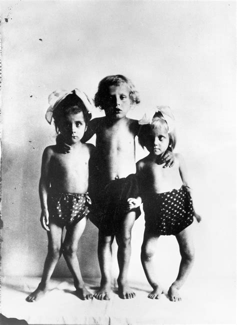 Photograph Three Children With Rickets Wellcome Collection