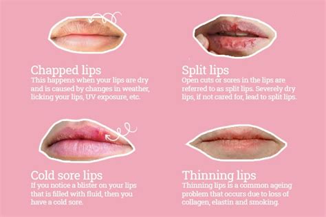 Expert Approved Lip Care Tips For Soft And Supple Pout Be Beautiful India