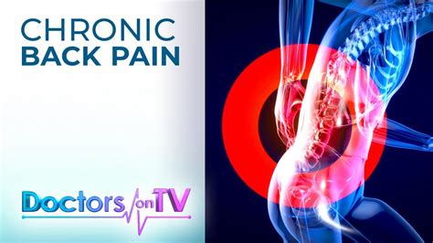 Chronic Back Pain Doctors On Tv Youtube