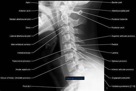 Spine Cervical Vertebrae C I C Vii Radiography Atlas C I